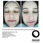Real Before and After results for PRIORI DNA Recovery Serum